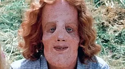 Rocky-Dennis.Mask.webp