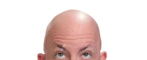 bald_head.jpg