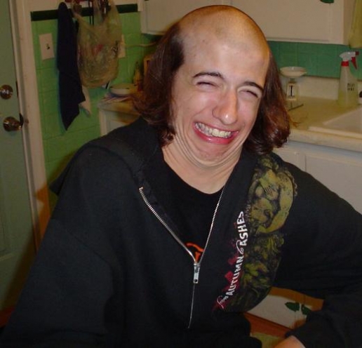 ugly-bald-men-pictures.jpg