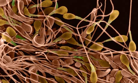Human-Sperm-007.jpg