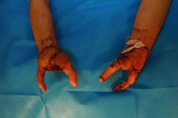 pincer-hands-2997221.png