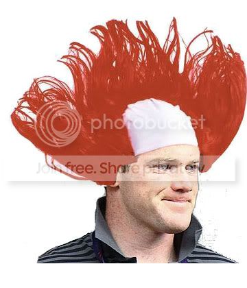 rooneyhairimplant.jpg