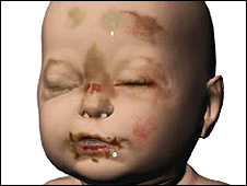 _45194673_babyphead_226.jpg