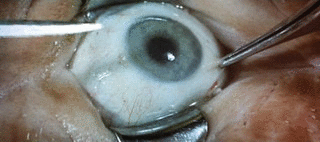 tumblr_mxuyv9tnUR1spfa8do1_400.gif