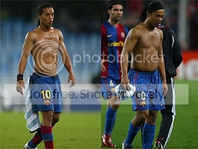 RonaldinhoBeforeAfter1.jpg