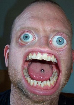 UglyMan1269198759.jpg